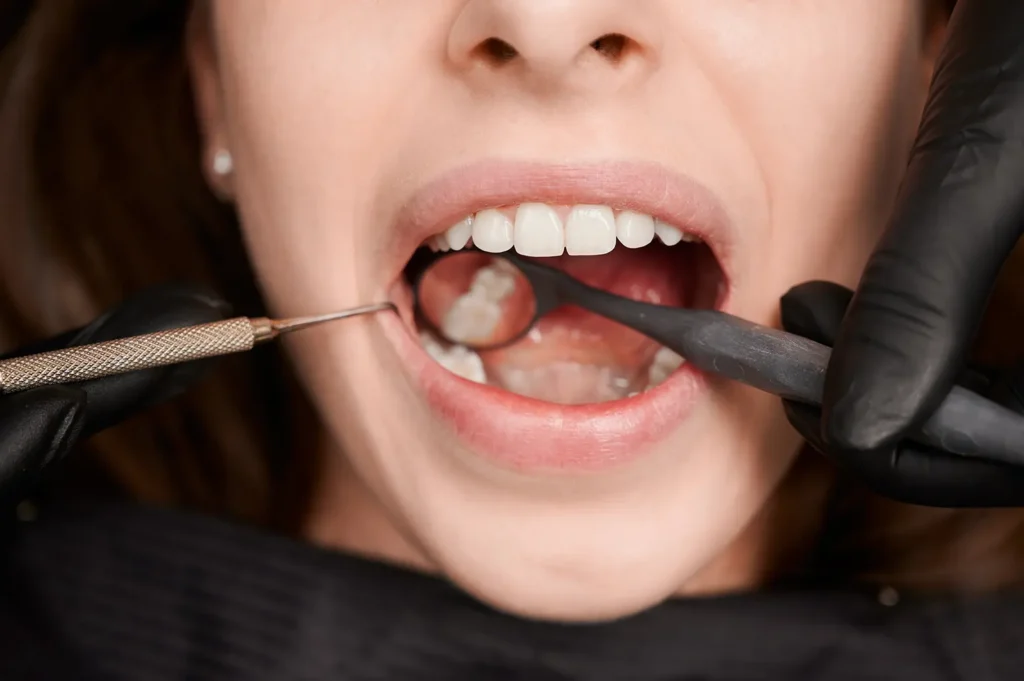 Dentist examining a patient's teeth, emphasizing the importance of using a mouth guard for dental protection. Legacy Smiles in Billings, MT offers professional dental care and custom-fitted mouth guards for optimal oral health.