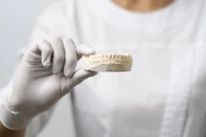 Close-up of a dental professional holding a model of teeth, showcasing the use of dental inlays for restoration at Legacy Smiles.